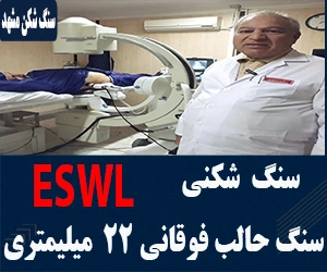 سنگ شکن حالب فوقانی با دستگاه پیشرفته